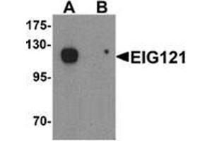 Western blot analysis of EIG121 in MCF7 cell lysate with EIG121 Antibody  at 1 ug/mL in (A) the absence and (B) the presence of blocking peptide. (ELAPOR1 抗体  (C-Term))