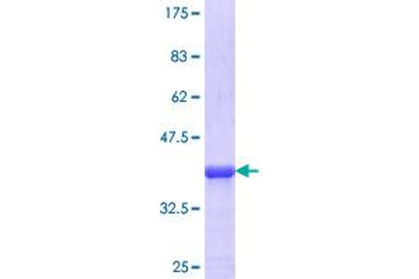 Cytokeratin 13 Protein (AA 258-357) (GST tag)