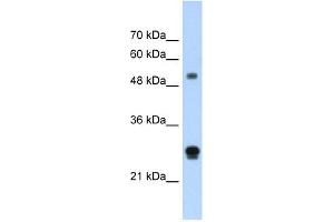 IGSF1 antibody used at 1. (IGSF1 抗体  (N-Term))