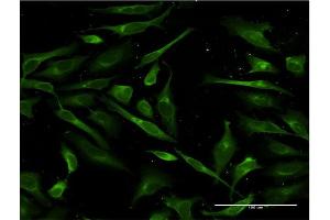 Immunofluorescence of monoclonal antibody to SFTPA1 on HeLa cell. (Surfactant Protein A1 抗体  (AA 83-199))