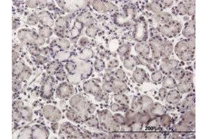 Immunohistochemistry (Formalin-fixed Paraffin-embedded Sections) (IHC (fp)) image for anti-Nuclear Receptor Subfamily 2, Group C, Member 2 (NR2C2) (AA 1-530) antibody (ABIN1989524)
