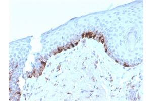 Formalin-fixed, paraffin-embedded human Skin stained with TYRP1-Monospecific Mouse Monoclonal Antibody (TYRP1/3282). (Tyrosinase-Related Protein 1 抗体  (AA 257-377))