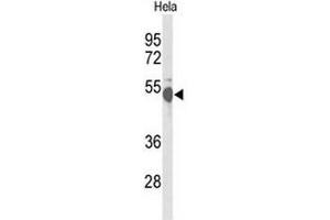 Western blot analysis of CREB3L2 Antibody (C-term) in Hela cell line lysates (35µg/lane). (CREB3L2 抗体  (C-Term))