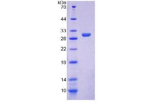 SDS-PAGE analysis of Human ELMO2 Protein. (ELMO2 蛋白)