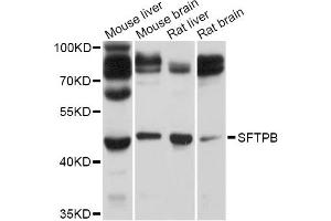 Western blot analysis of extracts of various cell lines, using SFTPB Antibody (ABIN5995955) at 1/1000 dilution. (SFTPB 抗体)