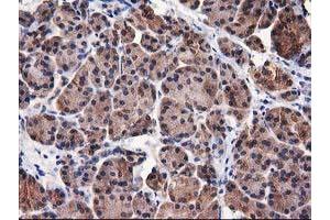 Image no. 5 for anti-Destrin (Actin Depolymerizing Factor) (DSTN) antibody (ABIN1497910) (Destrin 抗体)