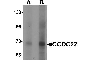 Western blot analysis of CCDC22 in 293 cell lysate with CCDC22 antibody at (A) 1 and (B) 2 µg/mL. (CCDC22 抗体  (N-Term))