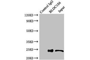 Immunoprecipitating BLOC1S6 in HEK293 whole cell lysate Lane 1: Rabbit control IgG instead of (1 μg) instead of ABIN7145610 in HEK293 whole cell lysate. (Pallidin 抗体  (AA 1-170))