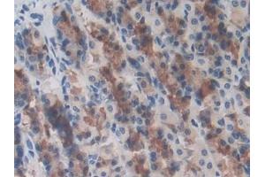 Detection of LRRC32 in Rat Stomach Tissue using Polyclonal Antibody to Leucine Rich Repeat Containing Protein 32 (LRRC32) (LRRC32 抗体  (AA 162-405))