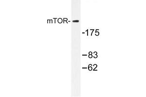 Image no. 1 for anti-Mechanistic Target of Rapamycin (serine/threonine Kinase) (mTOR) antibody (ABIN272127) (MTOR 抗体)