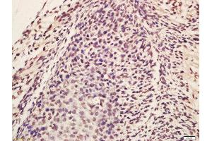 Formalin-fixed and paraffin embedded mouse embryo labeled with Rabbit Anti-Lin28 Polyclonal Antibody, Unconjugated (ABIN1386838) at 1:200 followed by conjugation to the secondary antibody and DAB staining (Lin28A/ B (AA 75-180) 抗体)