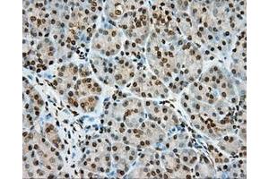 Immunohistochemical staining of paraffin-embedded Human colon tissue using anti-MTRF1L mouse monoclonal antibody. (MTRF1L 抗体)