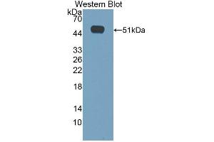 Western blot analysis of the recombinant protein. (CACNA1H 抗体  (AA 2160-2359))