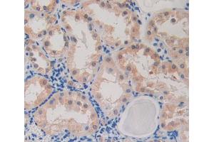 IHC-P analysis of Kidney tissue, with DAB staining. (CARD9 抗体  (AA 26-283))