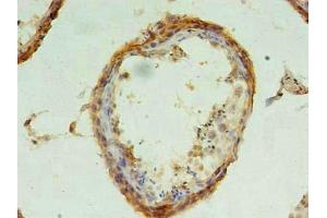 Immunohistochemistry of paraffin-embedded human testis tissue using ABIN7147533 at dilution of 1:100 (CHMP6 抗体  (AA 2-201))