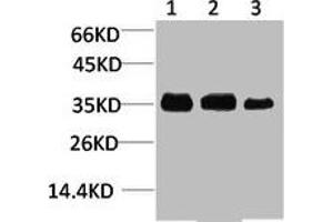 Western blot analysis of 1) Human Brain Tissue, 2) Mouse Brain Tissue, 3) Rat Brain Tissue using L-type Ca++ CP γ4 Polyclonal Antibody. (CACNG4 抗体)