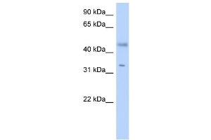 WB Suggested Anti-RDHE2 Antibody Titration: 0. (SDR16C5 抗体  (Middle Region))