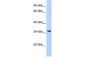 WB Suggested Anti-LYPLA2 Antibody Titration: 0. (LYPLA2 抗体  (N-Term))