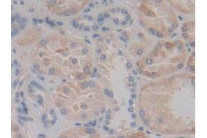 Detection of MAP2K6 in Human Kidney Tissue using Polyclonal Antibody to Mitogen Activated Protein Kinase Kinase 6 (MAP2K6) (MAP2K6 抗体  (AA 46-306))