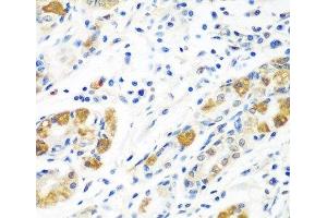 Immunohistochemistry of paraffin-embedded Human stomach using BLVRB Polyclonal Antibody at dilution of 1:100 (40x lens). (BLVRB 抗体)