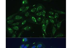 Immunofluorescence analysis of U-2 OS cells using COX6A1 Polyclonal Antibody at dilution of 1:100 (40x lens). (COX6A1 抗体)