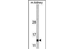 Western blot analysis of DNAJC19 Antibody in mouse kidney tissue lysates (35ug/lane) (DNAJC19 抗体  (AA 55-84))