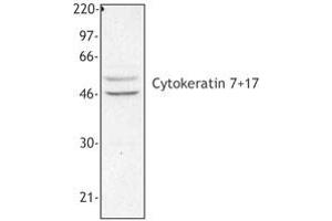 Image no. 1 for anti-Keratin 7/17 (KRT7/17) antibody (ABIN293955) (Keratin 7/17 抗体)