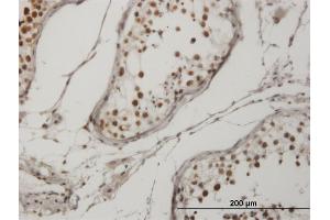 Immunoperoxidase of monoclonal antibody to CRKRS on formalin-fixed paraffin-embedded human testis. (CDK12 抗体  (AA 1281-1380))