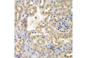 Immunohistochemistry (Paraffin-embedded Sections) (IHC (p)) image for anti-Sulfotransferase Family, Cytosolic, 2B, Member 1 (SULT2B1) (AA 1-365) antibody (ABIN6148720)