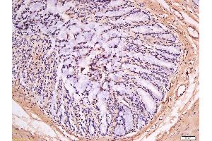 Formalin-fixed and paraffin embedded human kidney labeled with Anti-GSDMA Polyclonal Antibody, Unconjugated  at 1:300 followed by conjugation to the secondary antibody and DAB staining. (Gasdermin A 抗体  (AA 21-120))