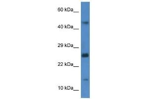 Western Blot showing Gabarapl2 antibody used at a concentration of 1. (GABARAPL2 抗体  (C-Term))