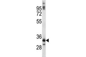 NKX6. (NKX6-1 抗体  (AA 284-312))