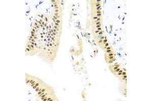 Immunohistochemistry of paraffin-embedded human liver injury using ZBTB17 antibody (ABIN5974597) at dilution of 1/100 (40x lens). (ZBTB17 抗体)