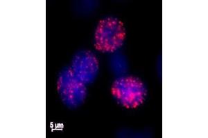 Histone H2AX phospho Ser139 antibody tested by immunofluorescence. (H2AFX 抗体  (pSer139))