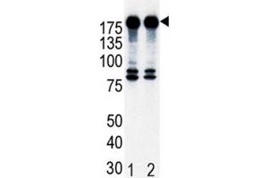 Western blot analysis of ErbB2 in T47D cell lysate, either noninduced (Lane 1) or induced with HRG (2). (ErbB2/Her2 抗体  (AA 21-52))