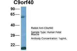 Host: Rabbit  Target Name: C9orf40  Sample Tissue: Human Fetal Muscle  Antibody Dilution: 1. (C9orf40 抗体  (Middle Region))
