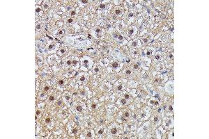 Immunohistochemistry (IHC) image for anti-Immunoglobulin mu Binding Protein 2 (IGHMBP2) (AA 540-720) antibody (ABIN7267848)