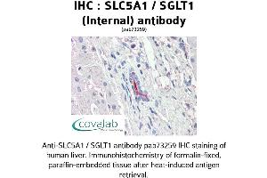 Image no. 2 for anti-Solute Carrier Family 5 (Sodium/glucose Cotransporter), Member 1 (SLC5A1) (Internal Region) antibody (ABIN1739389) (SLC5A1 抗体  (Internal Region))