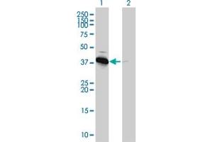 Western Blotting (WB) image for anti-Protein Kinase, AMP-Activated, beta 1 Non-Catalytic Subunit (PRKAB1) (AA 1-270) antibody (ABIN562362)