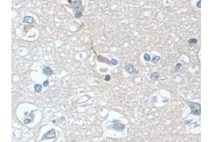 Detection of PLCB1 in Human Cerebrum Tissue using Polyclonal Antibody to Phospholipase C Beta 1 (PLCB1) (Phospholipase C beta 1 抗体  (AA 316-476))