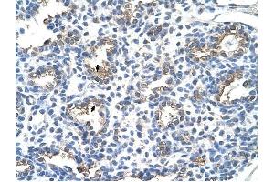 CEACAM6 antibody was used for immunohistochemistry at a concentration of 4-8 ug/ml to stain Alveolar cells (arrows) in Human Lung. (CEACAM6 抗体)