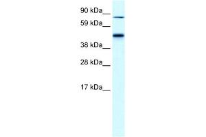 WB Suggested Anti-EPB42 Antibody Titration:  0. (EPB42 抗体  (Middle Region))