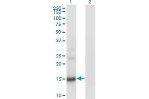 Western Blot analysis of BTG2 expression in transfected 293T cell line by BTG2 monoclonal antibody (M01), clone 1A5. (BTG2 抗体  (AA 59-158))