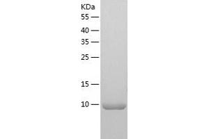 SH3BGRL3 Protein (AA 1-93) (His tag)