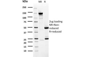 SDS-PAGE Analysis Purified BARX1 Mouse Monoclonal Antibody (BARX1/2759). (BARX1 抗体  (AA 155-254))