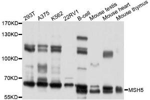 Western blot analysis of extracts of various cells, using MSH5 antibody. (MSH5 抗体)