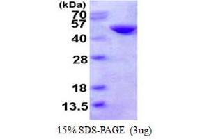 SDS-PAGE (SDS) image for Cystathionase (Cystathionine gamma-Lyase) (CTH) (AA 1-405) protein (His tag) (ABIN667632) (CTH Protein (AA 1-405) (His tag))
