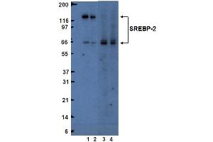 Western blot analysis of SREBP-2. (SREBF2 抗体  (AA 833-1141))