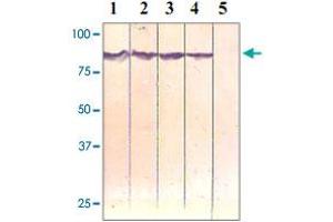 The cell lysate derived from HeLa was immunoprobed at a dilution of 1 : 500 by the following antibodies. (CTNNB1 抗体  (pSer37))
