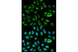 Immunofluorescence analysis of HeLa cells using GAS2 antibody (ABIN5970514). (GAS2 抗体)